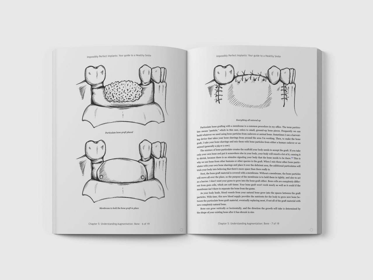 Dental Surgery