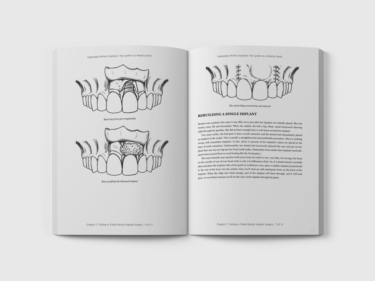 Dental Surgery