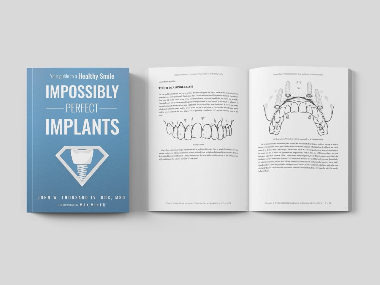 Dental surgery illustrations