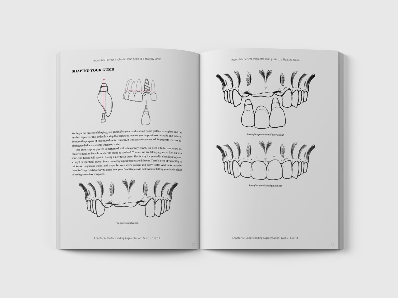 Dental Surgery