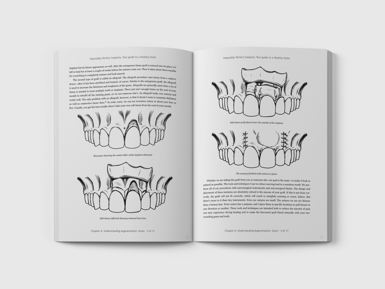 Dental Surgery