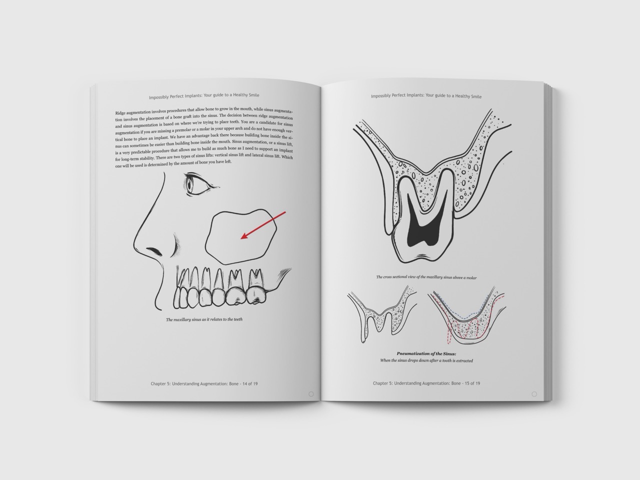 Dental Surgery